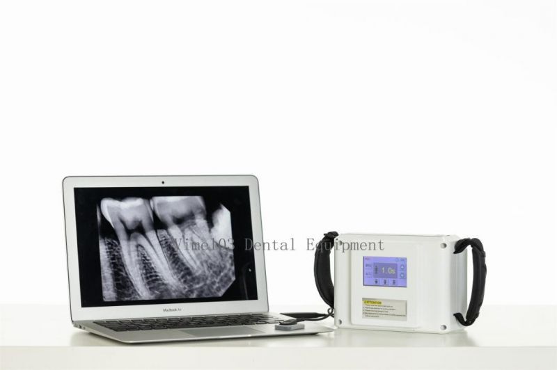 Portable Dental X-ray Machine/Dental Imaging System Touch Screen