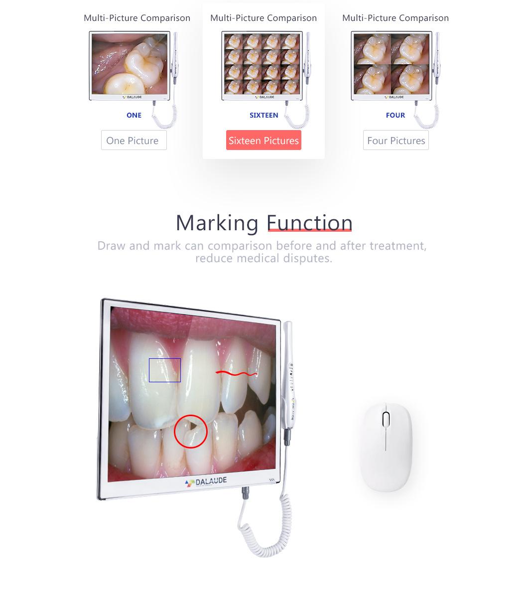 Upgraded Dental Tool Camera with Screen Dentistry Check Teeth Problem