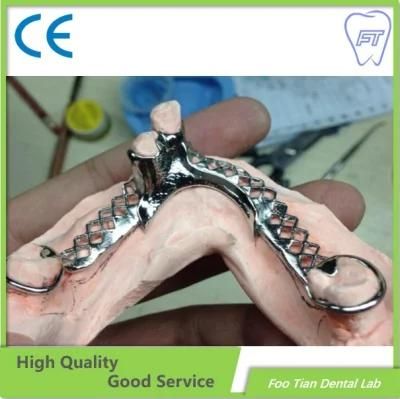 Dental Removable Denture Dental Cobalt Chrome Casting Framework Denture