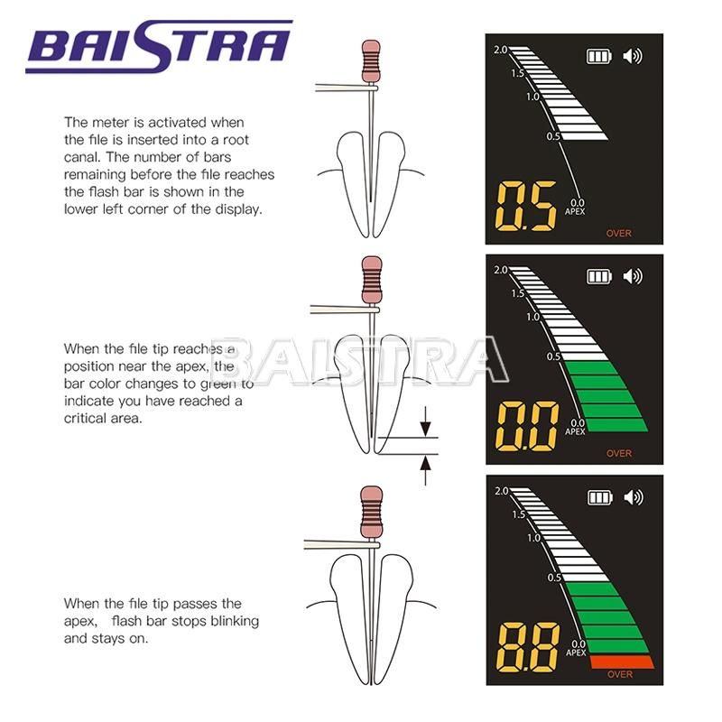 Top Quality LCD Screen Dental Root Canal Apex Locator