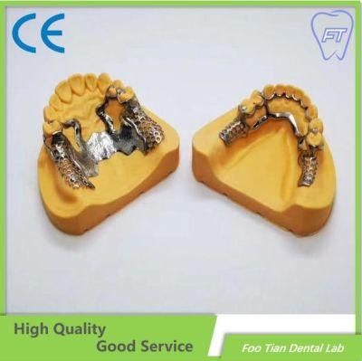 China Services Removable Metal Denture Cast Partial Framework