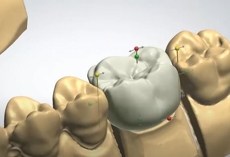 Dental 3shape Exocad Smile Design Service