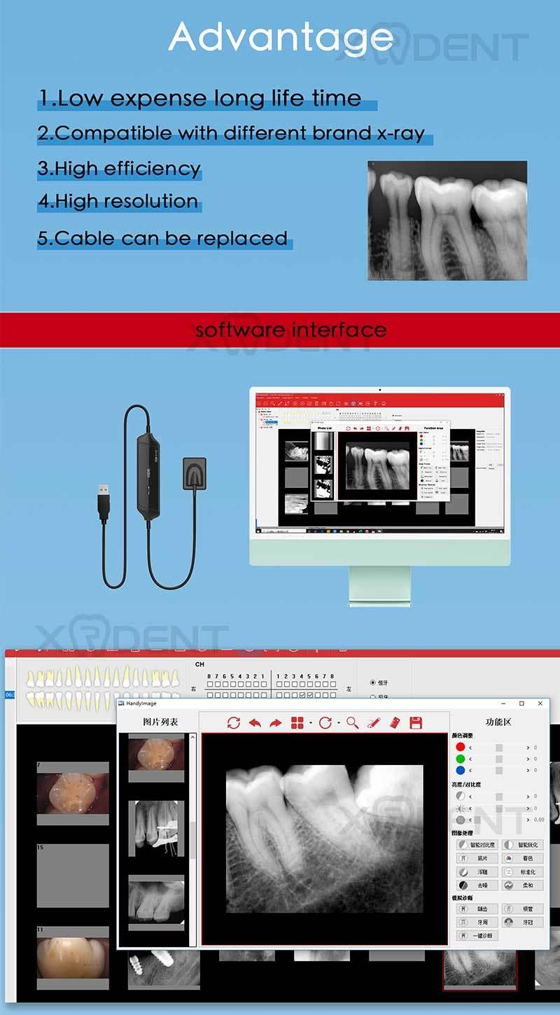 Rvg Dental Intraoral Digital Sensor for Dental Hospitals