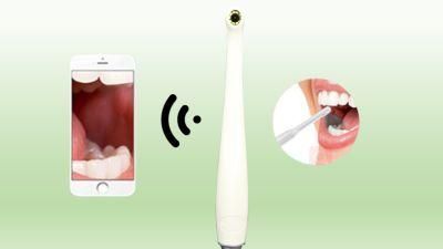 Link WiFi Scan Code to See Pictures Intraoral Camera