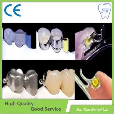 OEM Removable Denture Cast Partial Framework Dental