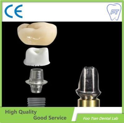 Veneer Zirconia Abutment Dental Restoration Custom Abutment on Selling