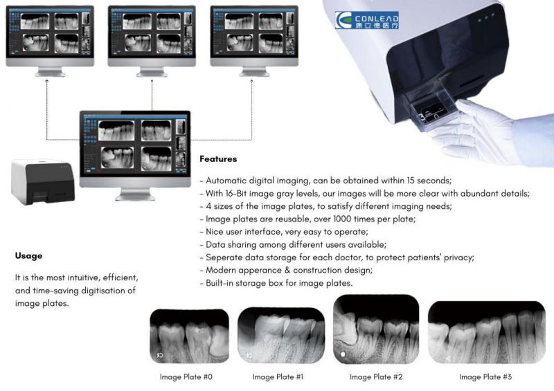 Phosphor Plate Digital X-ray Scanner, for Intra-Oral Imaging Size 0-3
