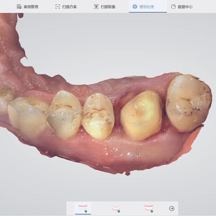 CE Approved Panda P2 3D CAD Cam Digital Dental Intra Oral Scanner Shinning Price