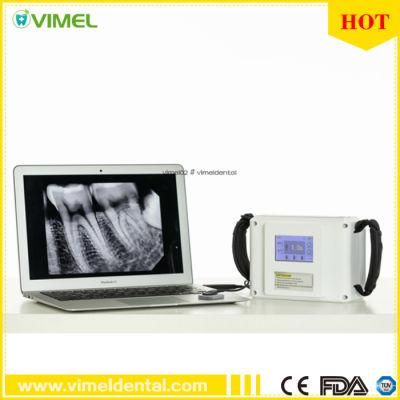 Dental Medical Equipment Portable X-ray Unit Machine