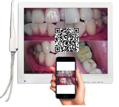 Waterproof Dental Intraoral Camera with 17 Inch Multimedia Screen