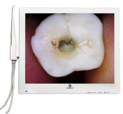 Dentist Best Multimedia Intraoral Camera with Best Pixel