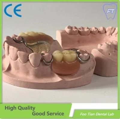 Dental Lab Removable Metal Denture Dental Implant Customized