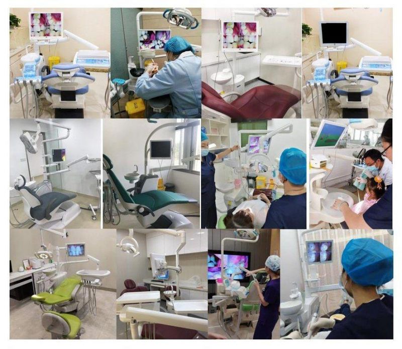 Dental Camera Is Suitable for Multimedia Video Playback