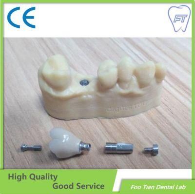 Selling Aesthetic Dental Zirconium Bridges From China Dental Lab