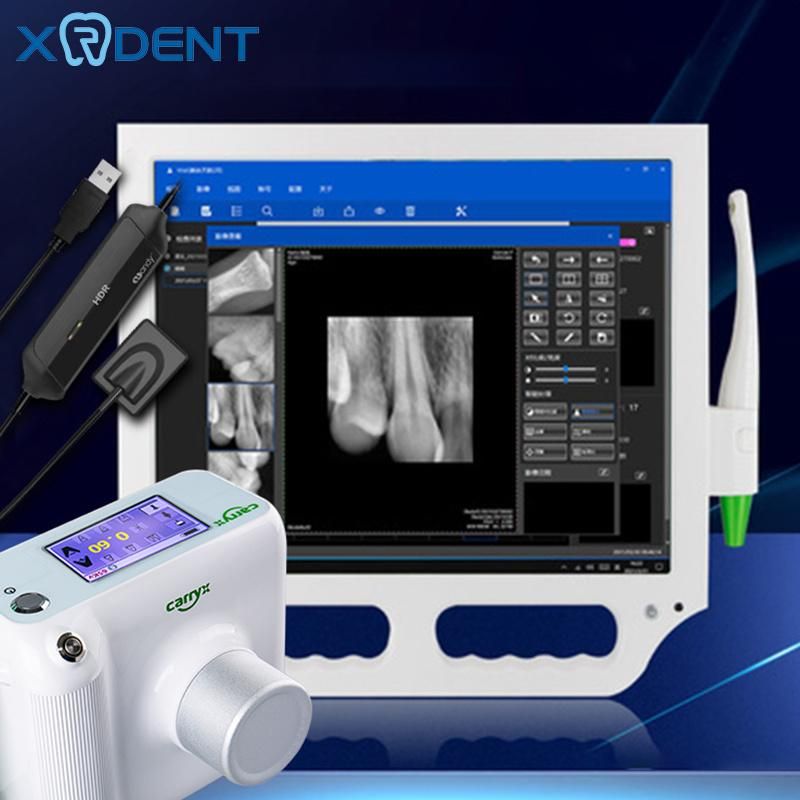 12 Million Pixels Touch Screen Dental Intraoral Camera with Monitor