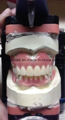 Full Arch Acrylic Denture