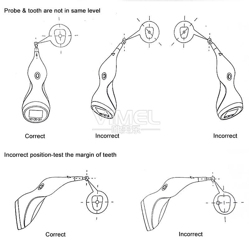 Dental Equipment Digital Shade Guide LED Tooth Color Comparator Machine