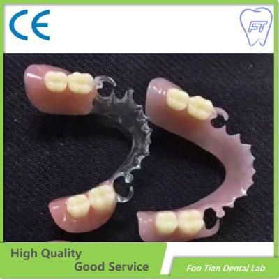 Cast Partial Framework Removable Denture Customized Good Product