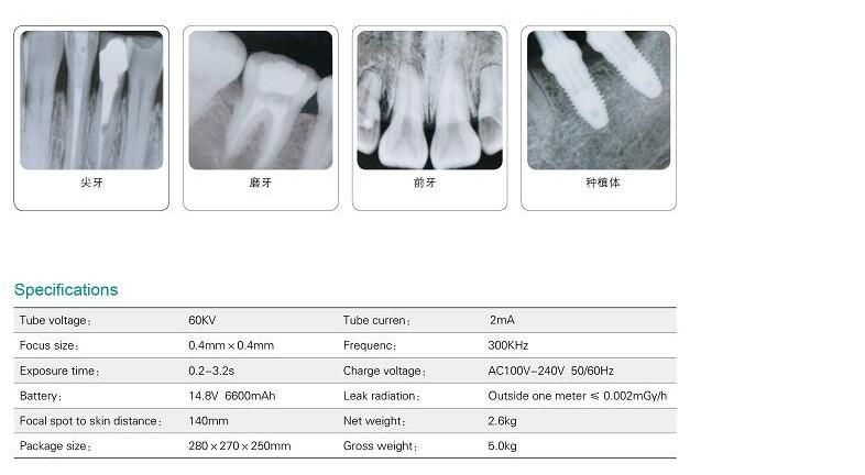 Dental Imaging System High Frequency Portable Dental X-ray Machine