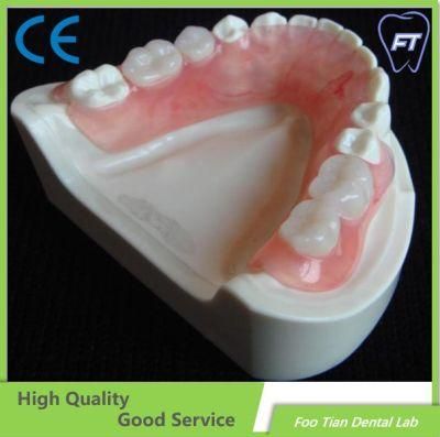 Selling Cast Partial Framework Denture Removable Restoration