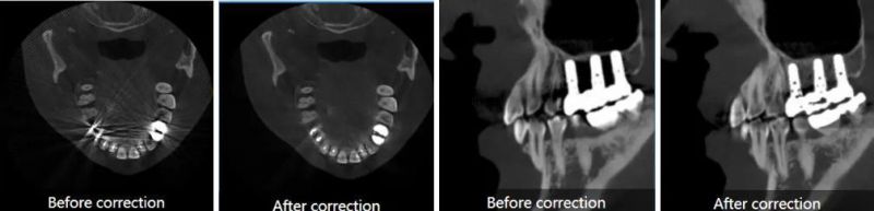 Smart3d-X 3-in-1 All Orthodontic Treatmen Extraordinary Image T New Intelligent Cbct Xray Scanner Equipment