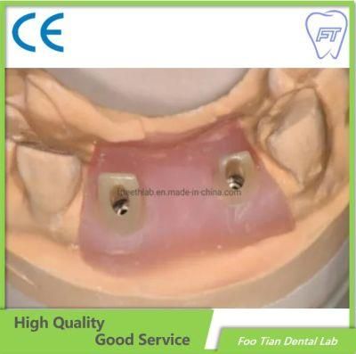 Customized Custom Abutment Dentistry Straumann Denture Lab