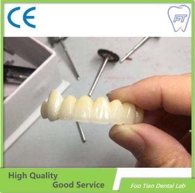 Dental Zirconium Bridges From China Dental Lab Denture