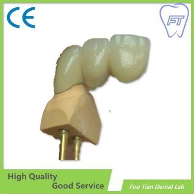 OEM Bruxzir Solid Stable Zirconia Bridge From China Dental Lab