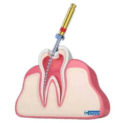 High Compatible Dental Endodontic Root Canal Files