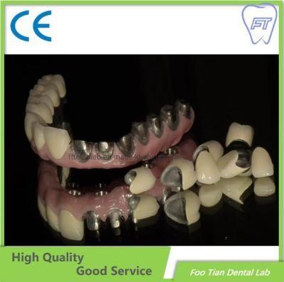 Implant System Osstem Straumann Denture Lab with Good Service