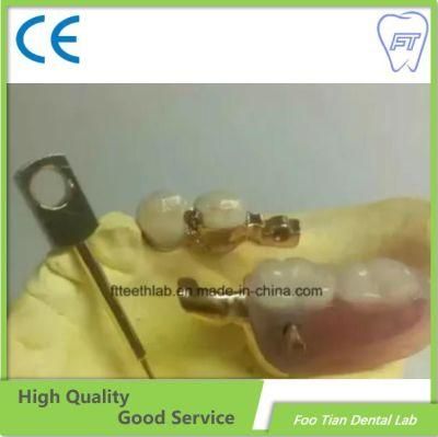 Dental Cobalt Chrome Casting Framework Customized