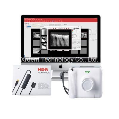 Small Light Professional Digital Portable Dental X-ray Equipment for Sale