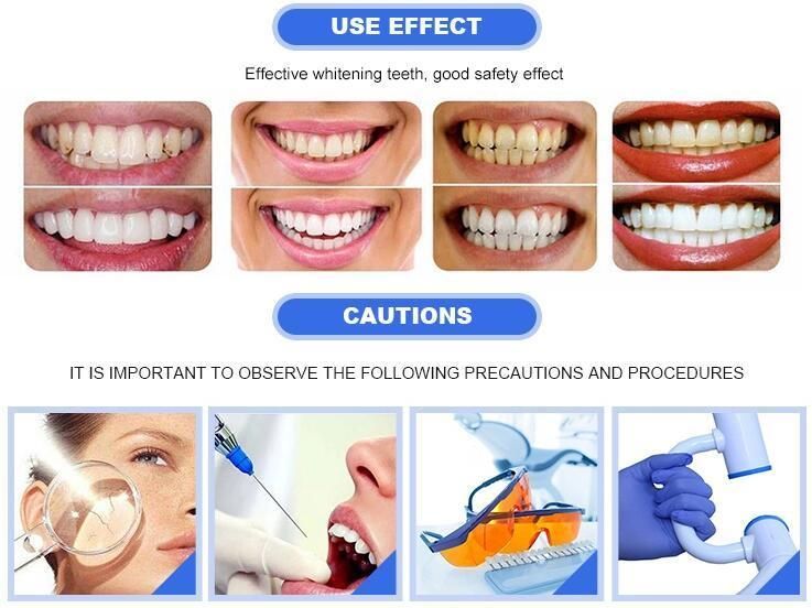 Charming Dental Teeth Whitening Machine Portable Dental Teeth Whitening Lamp with LED Red Blue Purple Light Bleaching Lamp