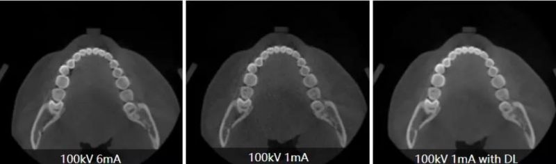 Smart 3D 3-in-1 Multifunctional Digital Dental Cbct Machine with True Mar Correction Module