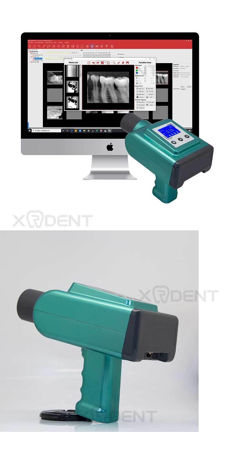 Factory Made Dental Portable Handheld Dental X-ray Machine