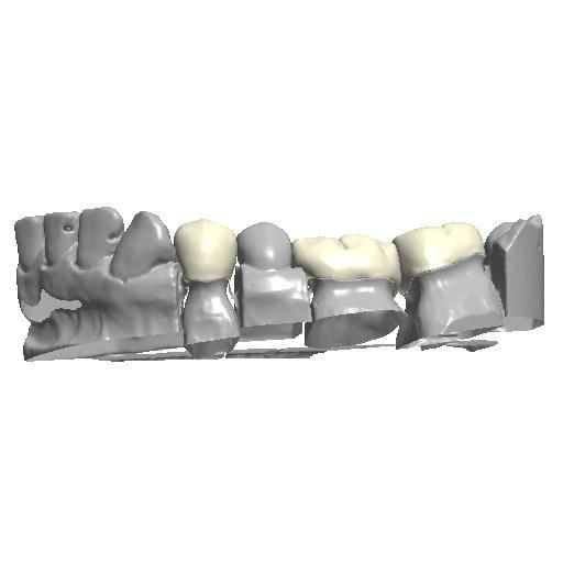 Dental 3shape Exocad Smile Design Service