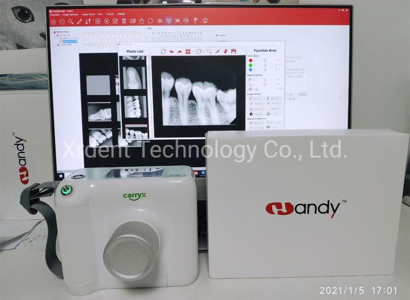 Touch Screen Carryx Portable Dental X Ray Dental Portable X-ray Unit Machine