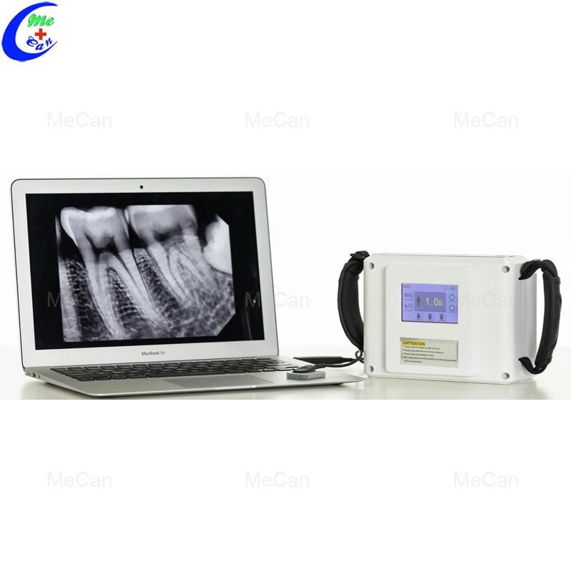 CE Digital Developer Film Processing Tank X Ray Dental Machine