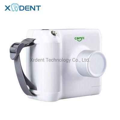 Best Portable Dental X Ray Unit for Dentist