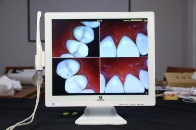 China Top Manufacturer High Piexl Digital Intraoral Camera