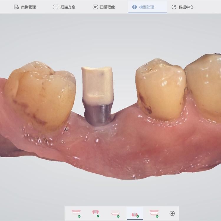 CE Approved Panda P2 3D CAD Cam Digital Dental Intra Oral Scanner Shinning Price