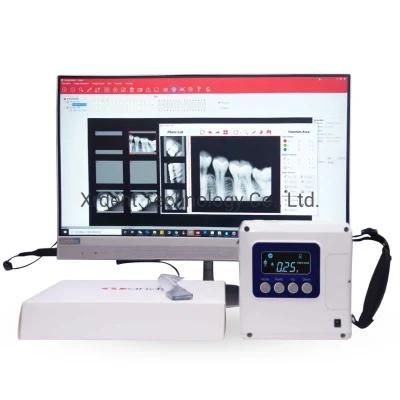 High Frequency 70kv 2mA Best Portable Dental X Ray Unit