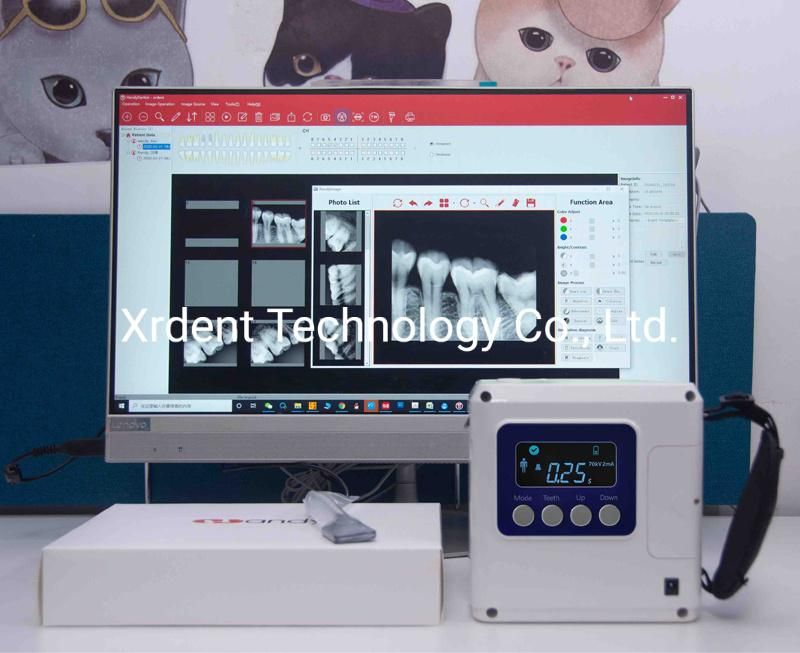 Long Tube 70kv 2mA Portable Dental X Ray Dental Equipment