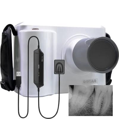 Digital Xray Sensor for Sale New Portable Dental X Ray Hot Sales