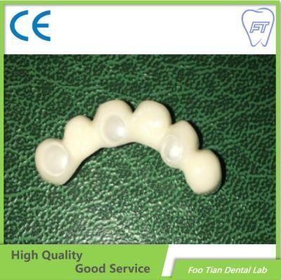 Good Service Aesthetic Dental Zirconium Bridges From China Dental Lab