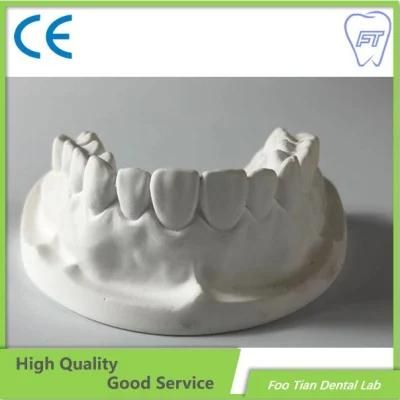 Dental Implant Orthodontics Study Model Removable Denture