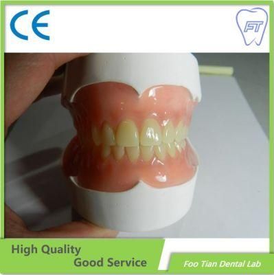 Factory Price Dental Cobalt Chrome Casting Framework Denture