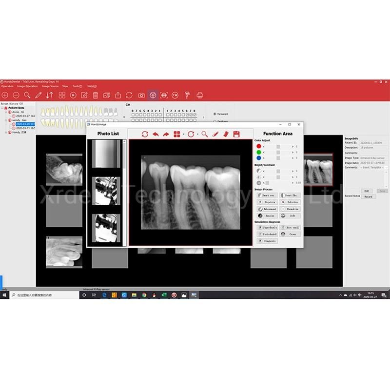 Digital Dental X Ray Imagingsensor Rvg