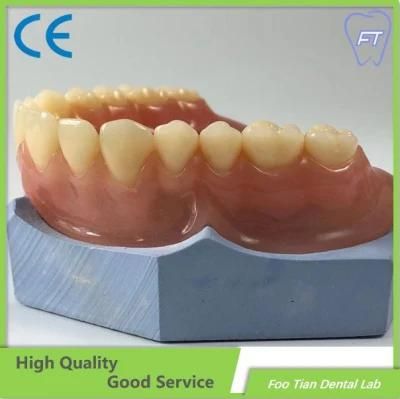 Manufacture Removable Denture Cast Partial Framework Dental Customized