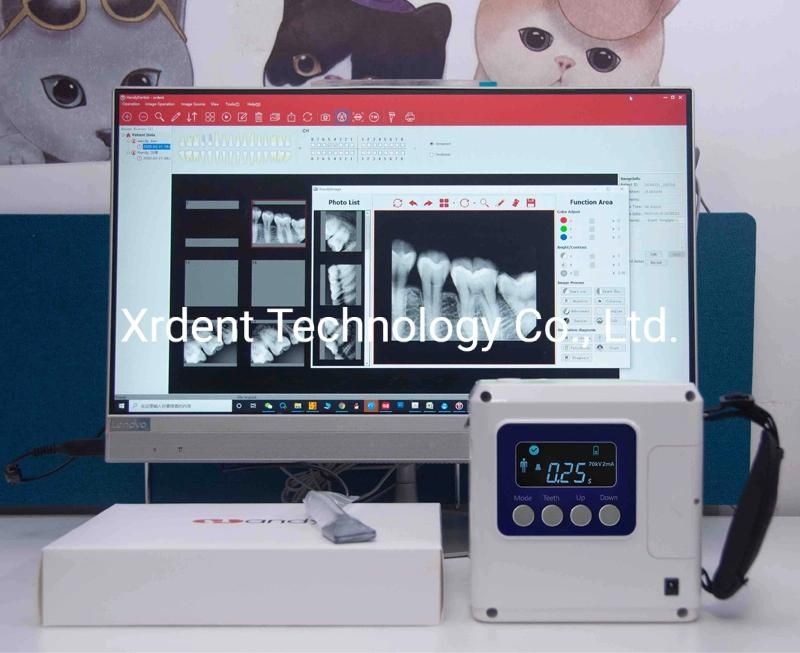 Factory Supply Dental Equipment Dental Portable X Ray Unit Dental X-ray Machine